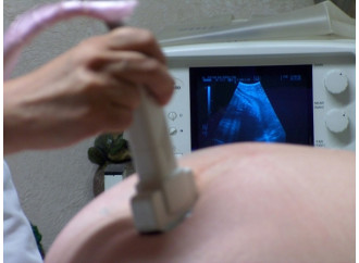 2 donne morte, medici "senza lavoro" e pilloleL'aborto cambia: mattanza di Stato a quota 90mila