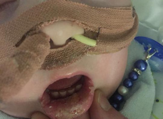 Le foto di Alfie maltrattato: «Altro che "best interest"»