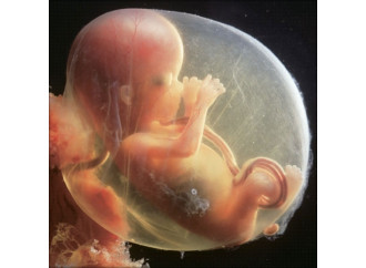 Mirna e Mara,
il non poter fare
a meno della vita