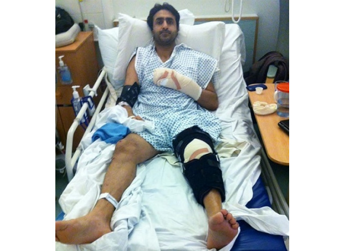 Nissar Hussain dopo l'aggressione subita Nissar Hussain dopo l'aggressione subita