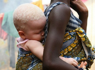 La Guinea Bissau dalla parte degli albini