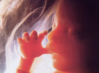Se 73 milioni di aborti all’anno sono un “diritto”
