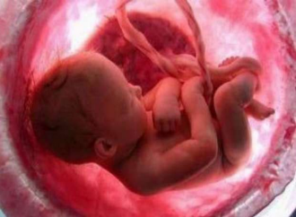 La prima causa di morte al mondo nel 2019? L’aborto