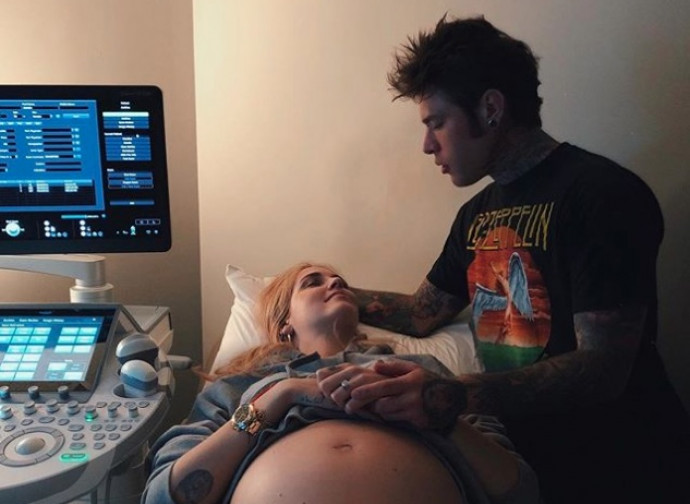 Chiara Ferragni, Leone e Fedez Chiara Ferragni, Leone e Fedez