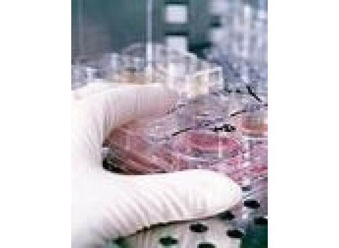 Fecondazione in vitro Fecondazione in vitro