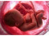 Salvano bambini dall’aborto: rischiano multe da 20 milioni di dollari