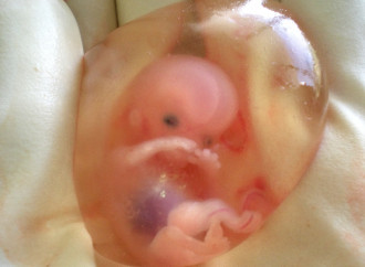 Aborto normalizzato, il male non è più percepito