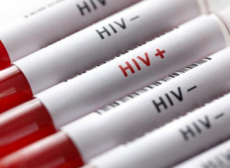 HIV, in Italia i più contagiati rimangono gli omosessuali