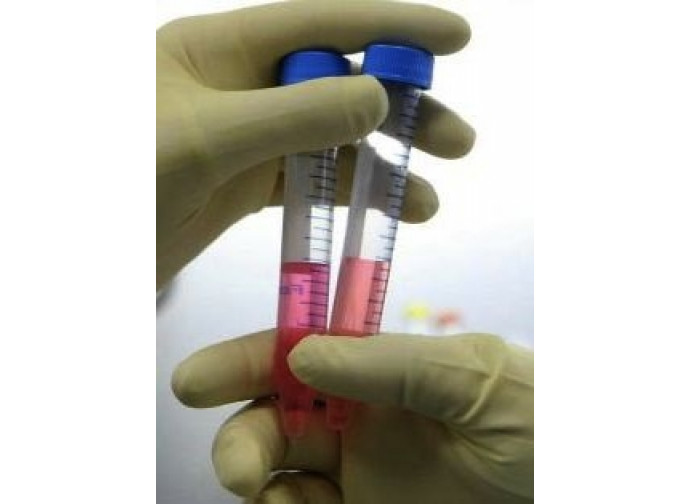 Ricerca contro la Sla Ricerca contro la Sla