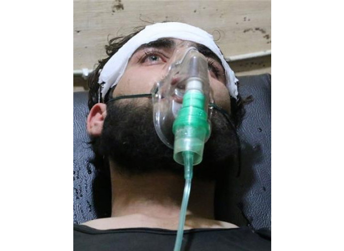 Siria, vittima dei gas Siria, vittima dei gas